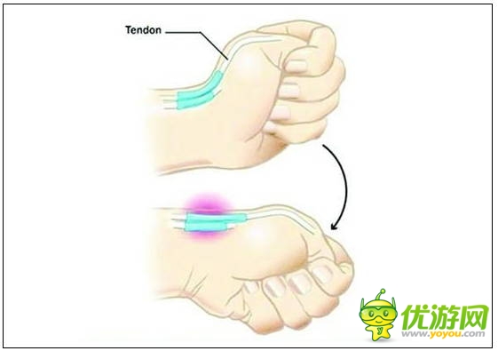 玩手機(jī)易患十大“智能手機(jī)病” 這些癥狀你都有嗎？